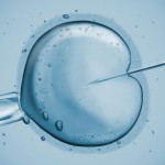 IVF-Treatment