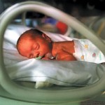 premature-infant